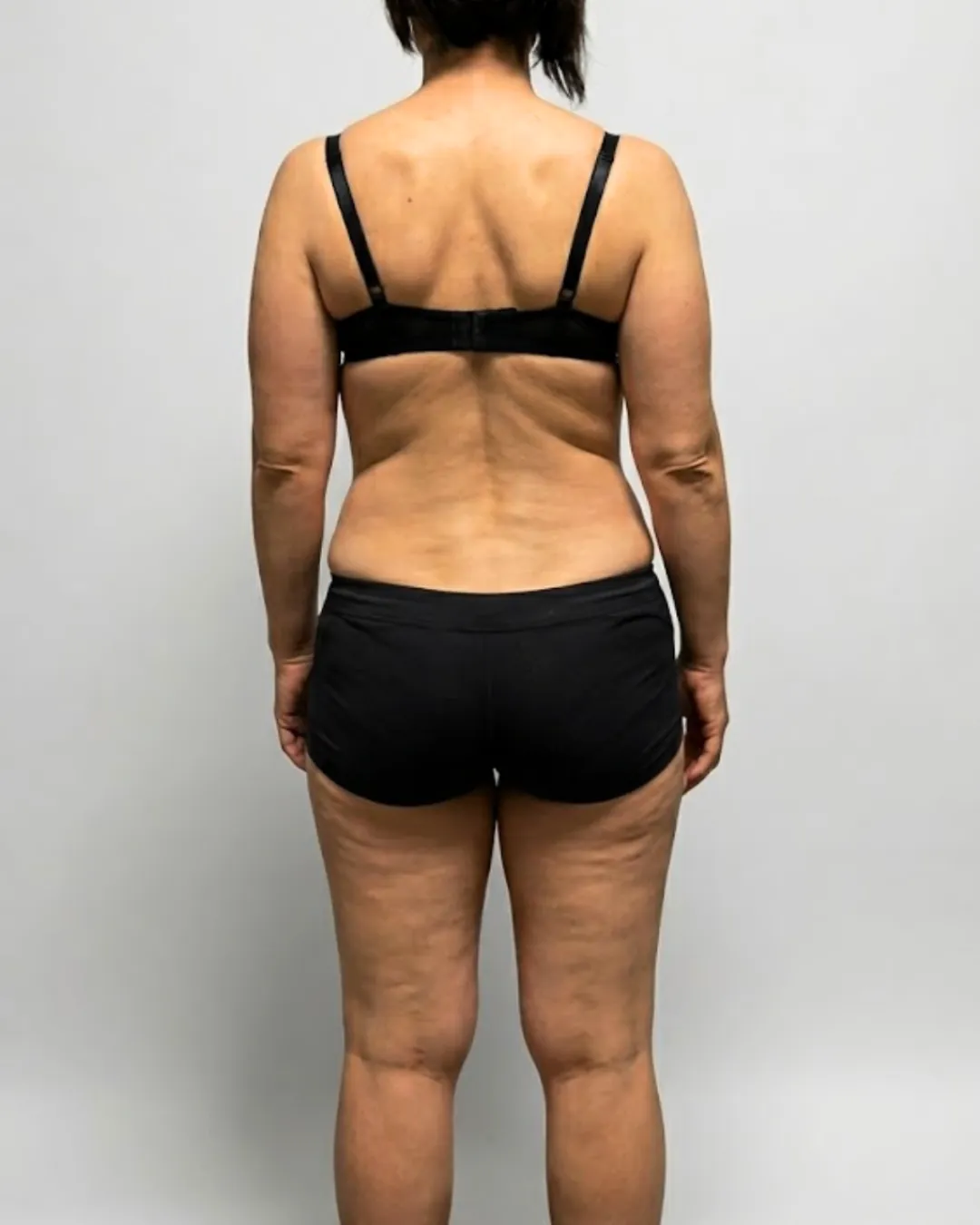 Female client before —  starting point
