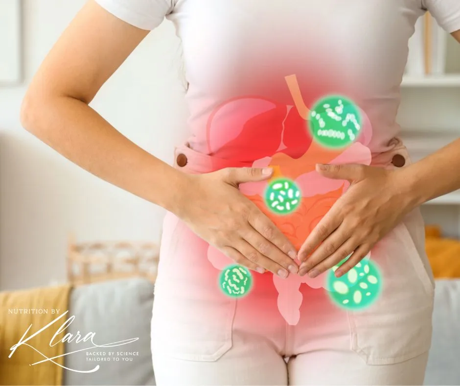 gut health, diverticulitis, bloating women